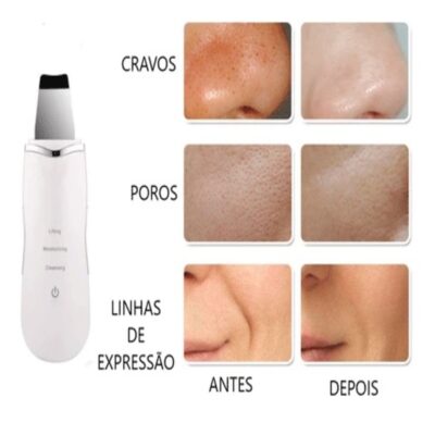 PEELING ULTRASSONICO PORTATIL LIFTING APARELHO LIMPEZA DE PELE ANTI ESPINHAS ACNE IONIZACAO FACIAL REMOVEDOR CRAVOS REJU - Imagem 4