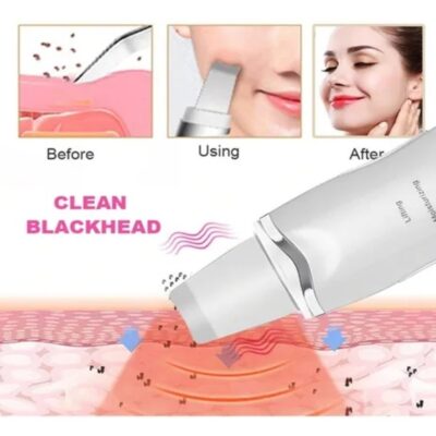 PEELING ULTRASSONICO PORTATIL LIFTING APARELHO LIMPEZA DE PELE ANTI ESPINHAS ACNE IONIZACAO FACIAL REMOVEDOR CRAVOS REJU - Imagem 5